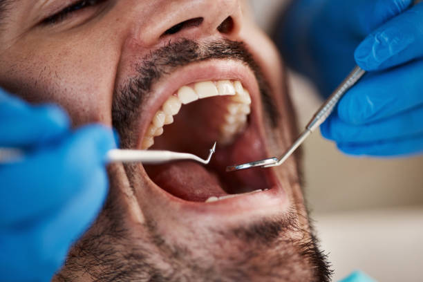 Best Oral Cancer Screening  in Moline, IL